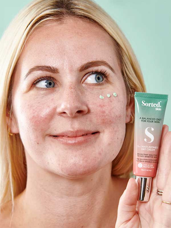 Sorted Skin Anti-Redness 5 in 1 Day Cream 30ml