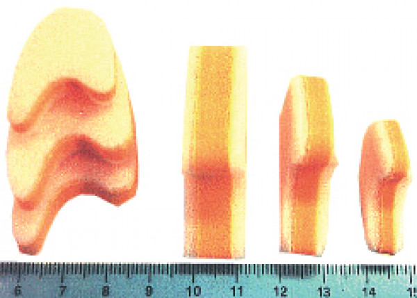 Varpaiden erottaja, keskikoko 10 mm 2 kpl