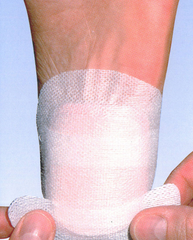 Chirofix -joustoteippi 10 cm x 10 m Chirofix -joustoteippi 10 cm x 10 m